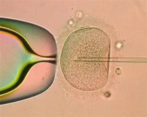 专业助孕机构推荐，实现生育梦想的可靠选择